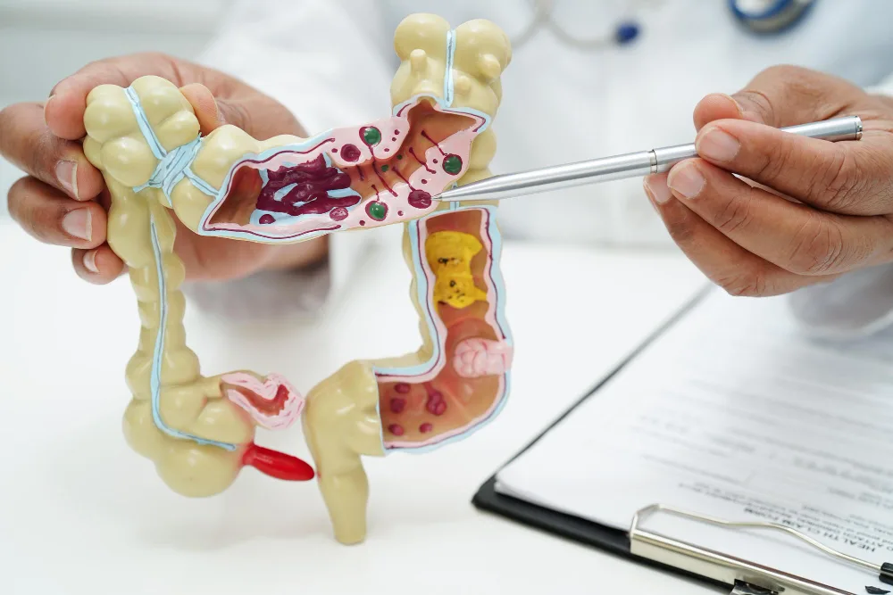 Tumores gastrointestinales, hígado y vías biliares